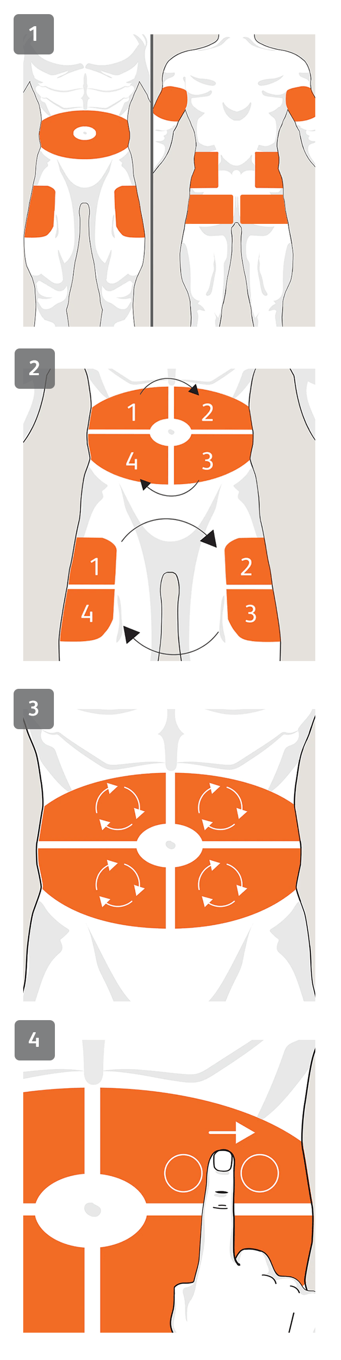 Guide to Insulin Injections